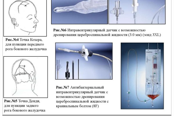 Kraken даркнет рынок